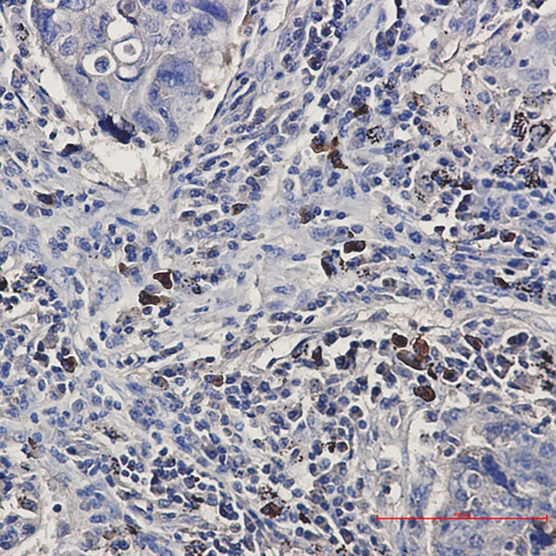 BNIP3L Rabbit Monoclonal Antibody