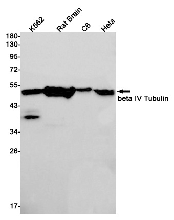 TUBB4A Antibody