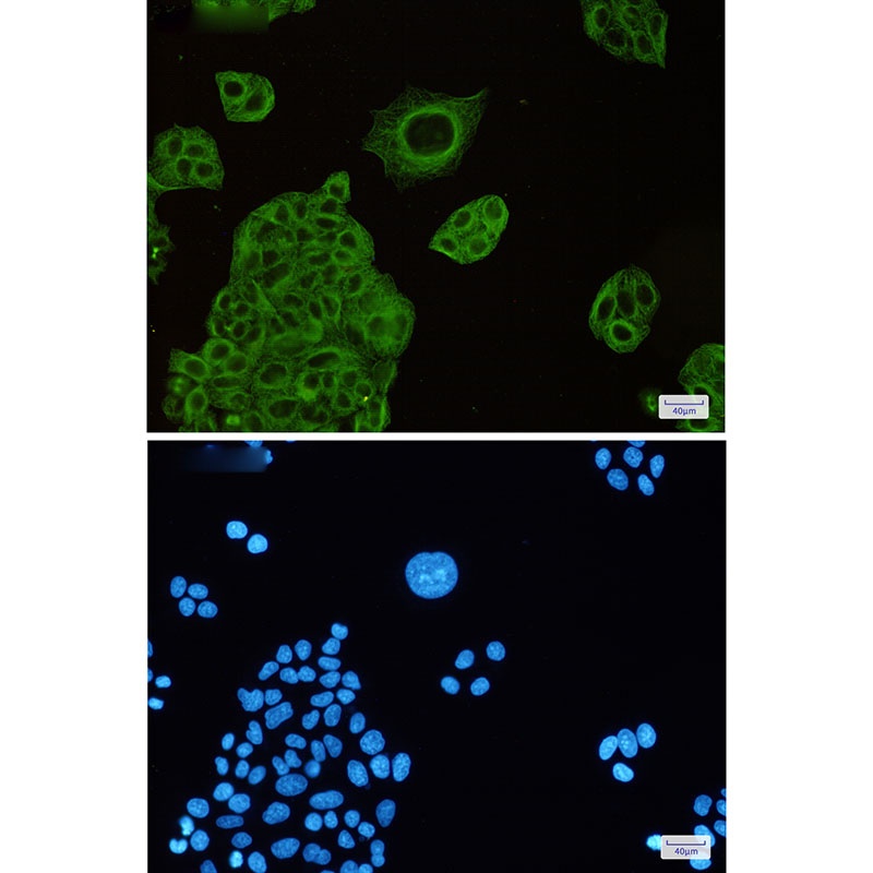TUBB4A Antibody