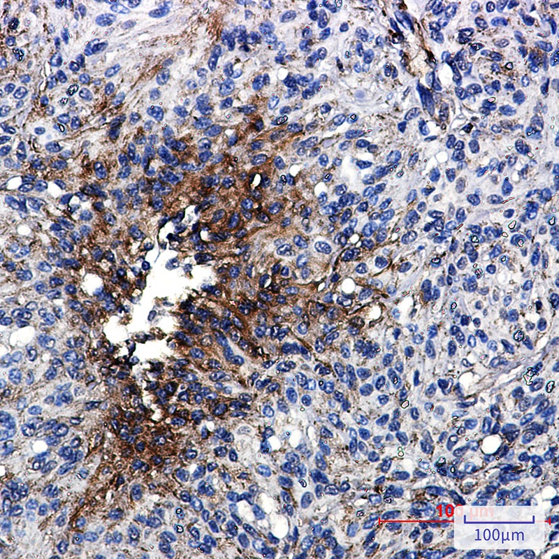 TUBB4A Antibody