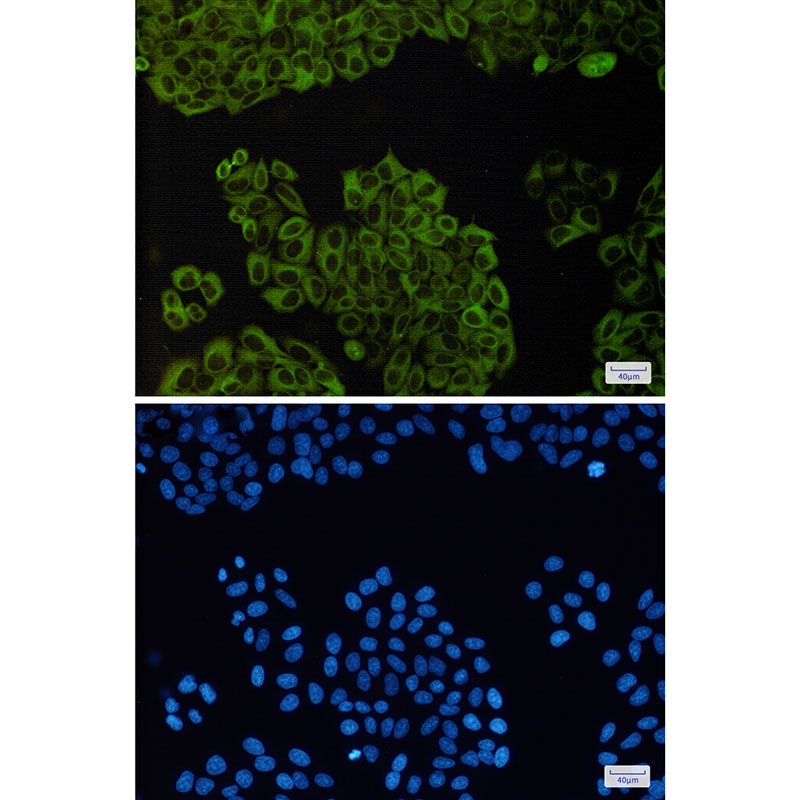 TUBB3 Antibody