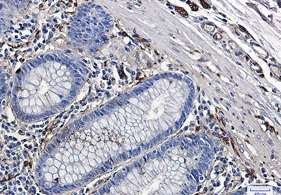 TUBB3 Antibody