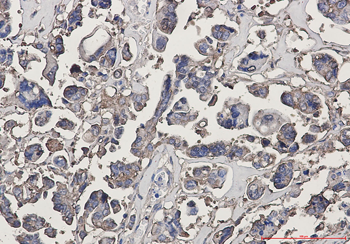 TUBB3 Antibody