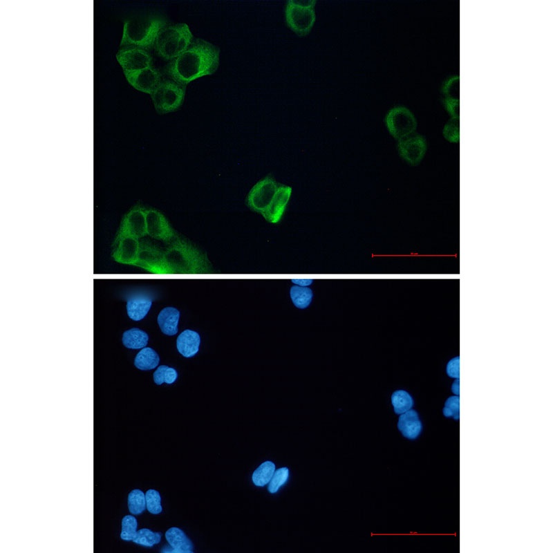 TUBB3 Antibody