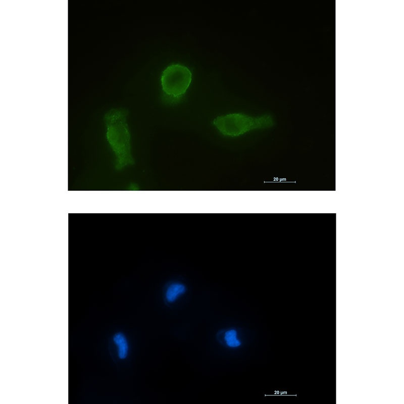 [KO] Bcl-XL Rabbit mAb