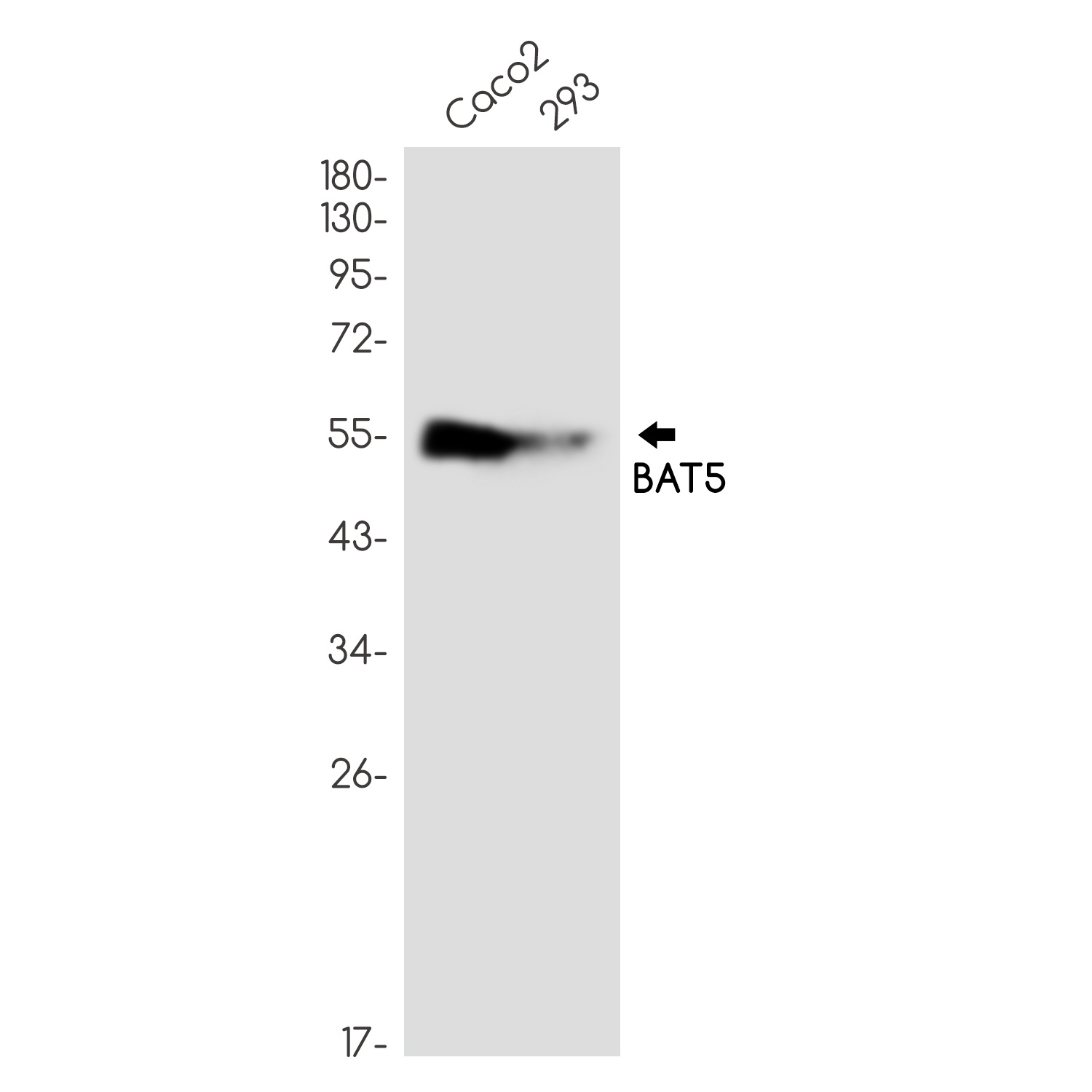 ABHD16A Antibody