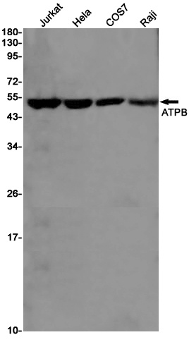 ATP5F1B Antibody