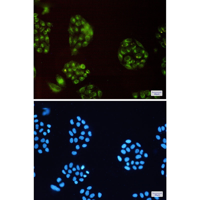 ATP6V0D1 Antibody