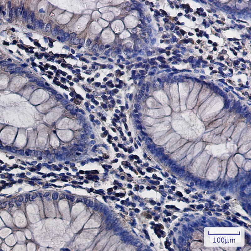 ATP6V0D1 Antibody