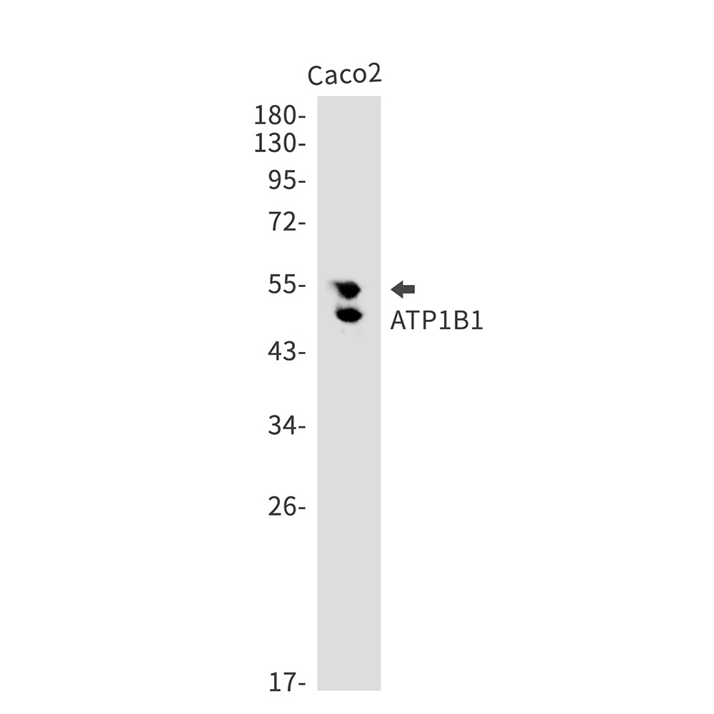 ATP1B1 Antibody
