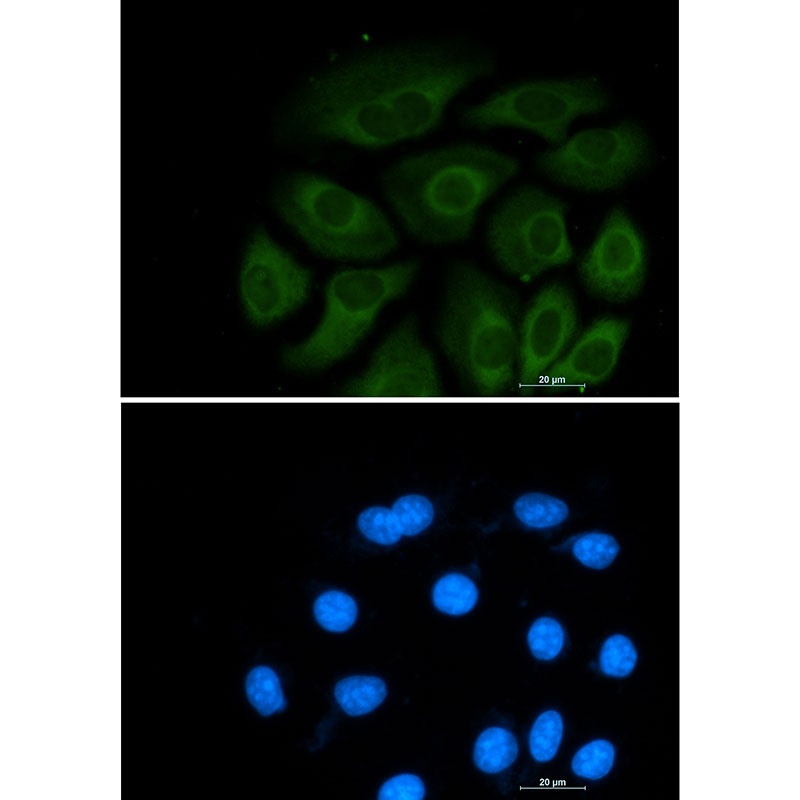 ACLY Antibody