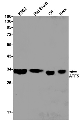 ATF5 Rabbit mAb