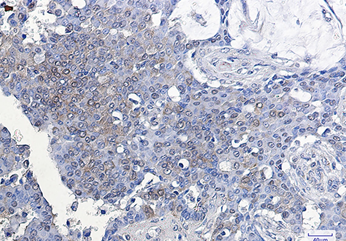 ATF5 Rabbit mAb
