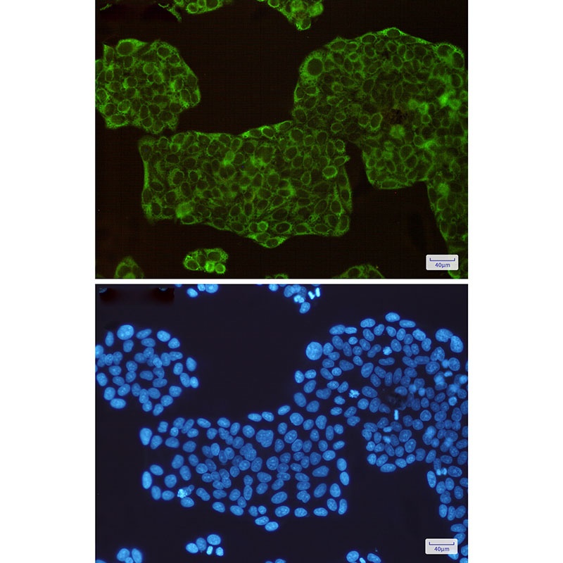 ASS1 Antibody