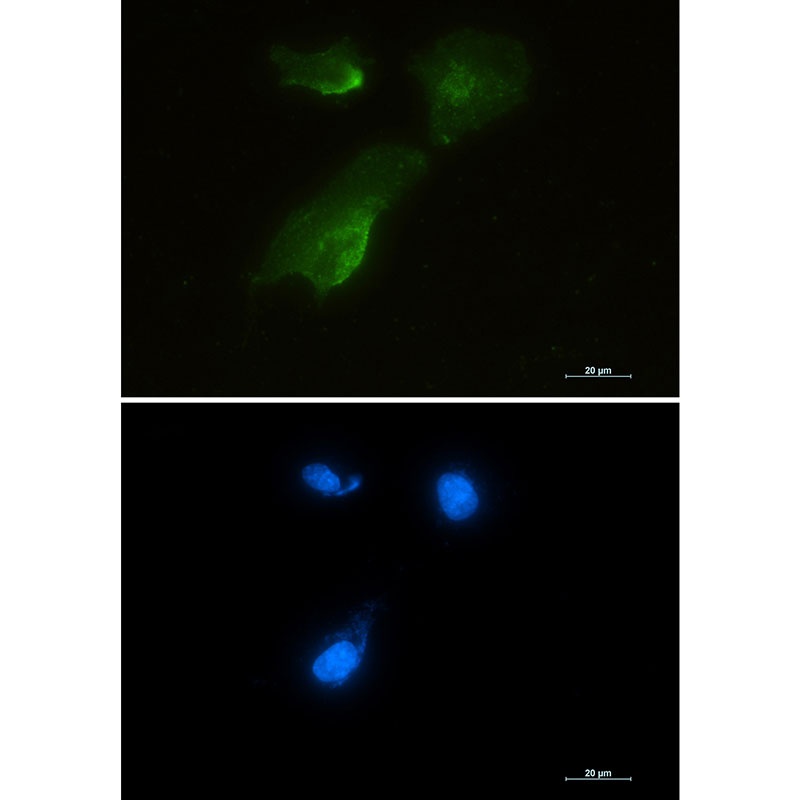 GOT1 Antibody