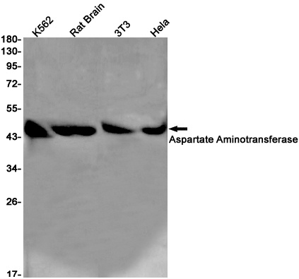 GOT1 Antibody