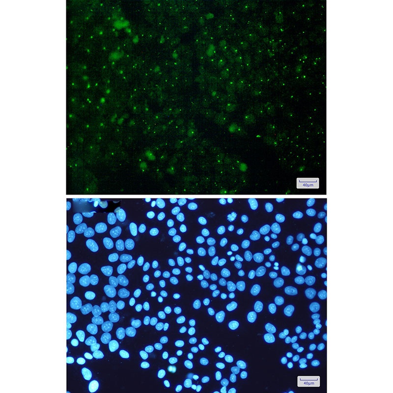 Aryl Hydrocarbon Receptor Rabbit mAb