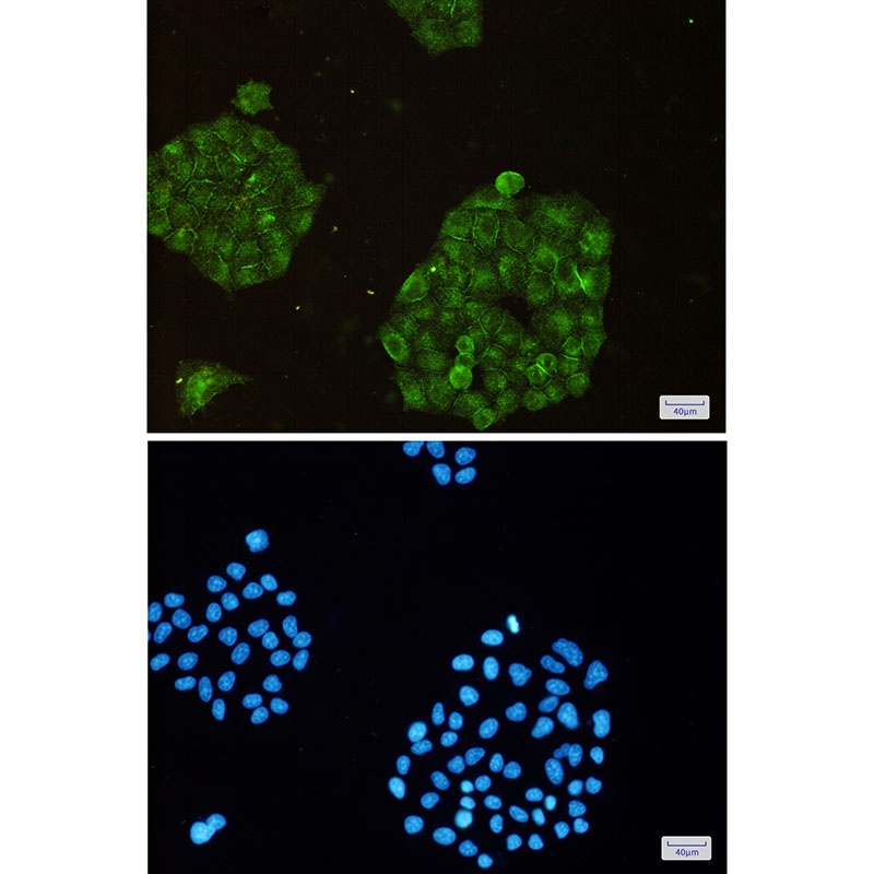 ARPC2 Antibody
