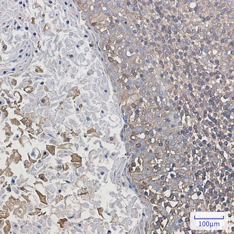 ARPC2 Antibody