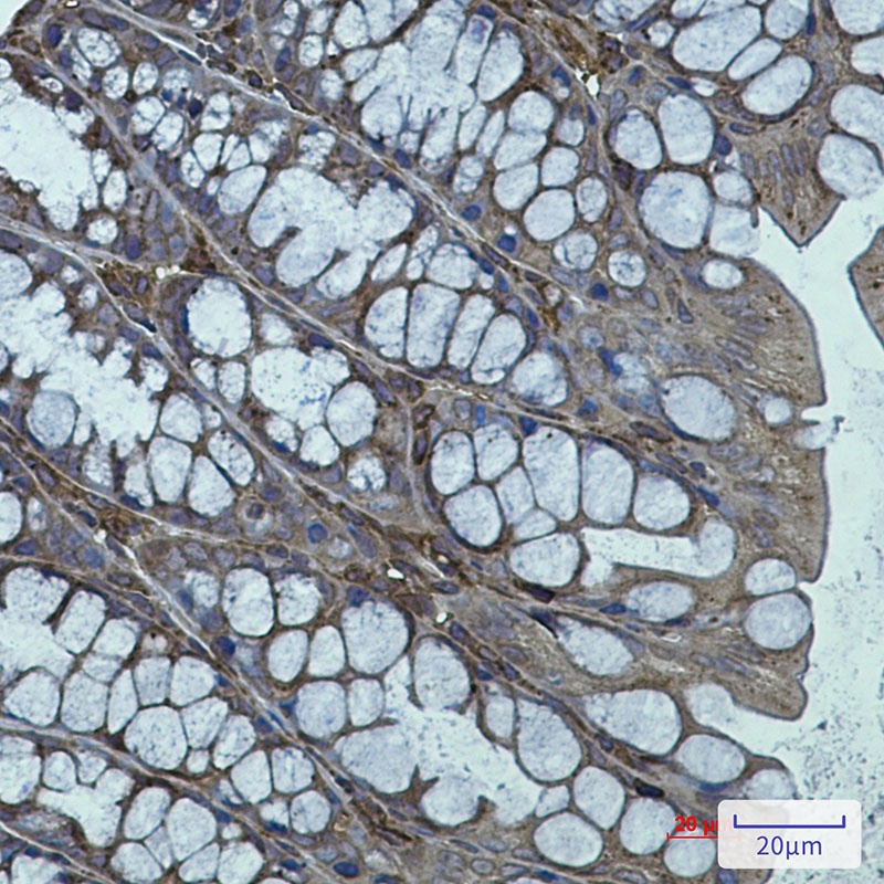 ACTR3 Antibody