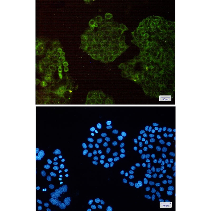 ACTR3 Antibody