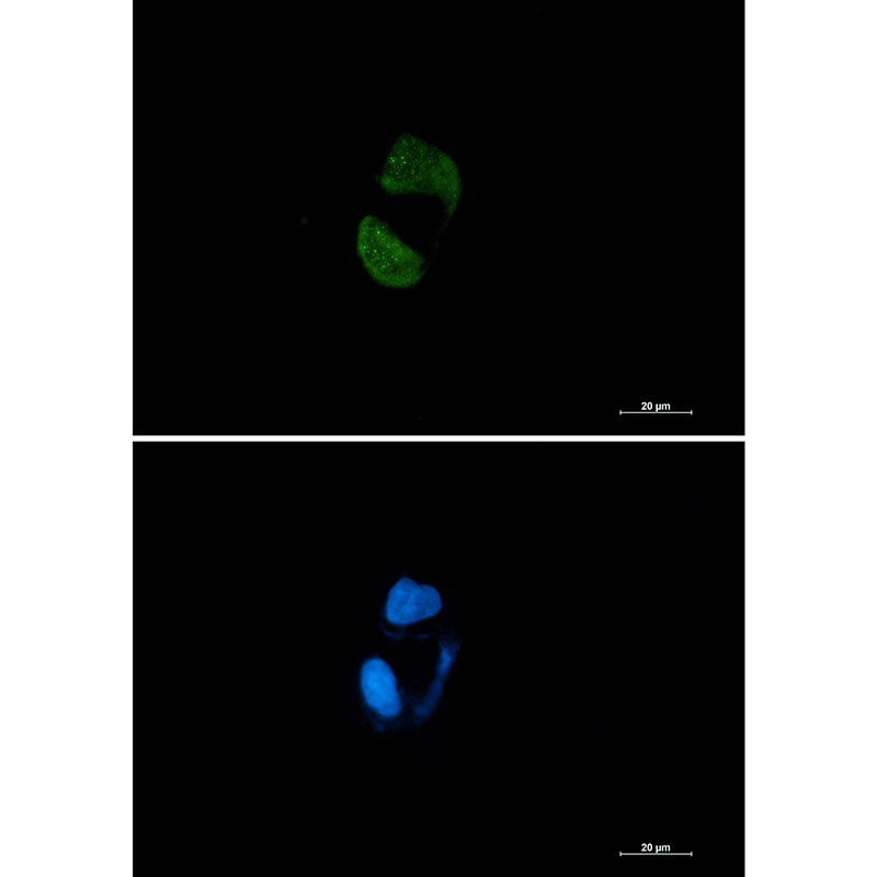 Argonaute 2 Rabbit mAb