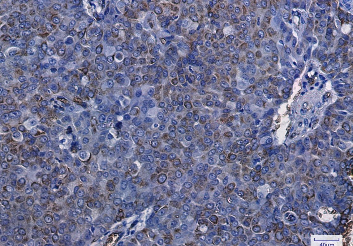 AQP1 Antibody