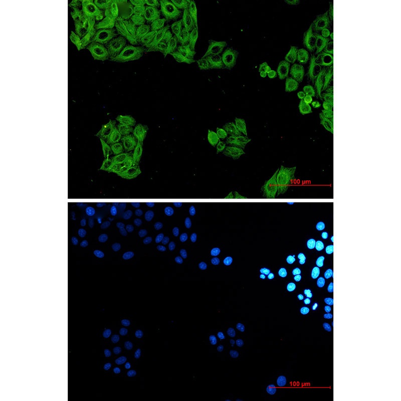 TUBA4A Antibody