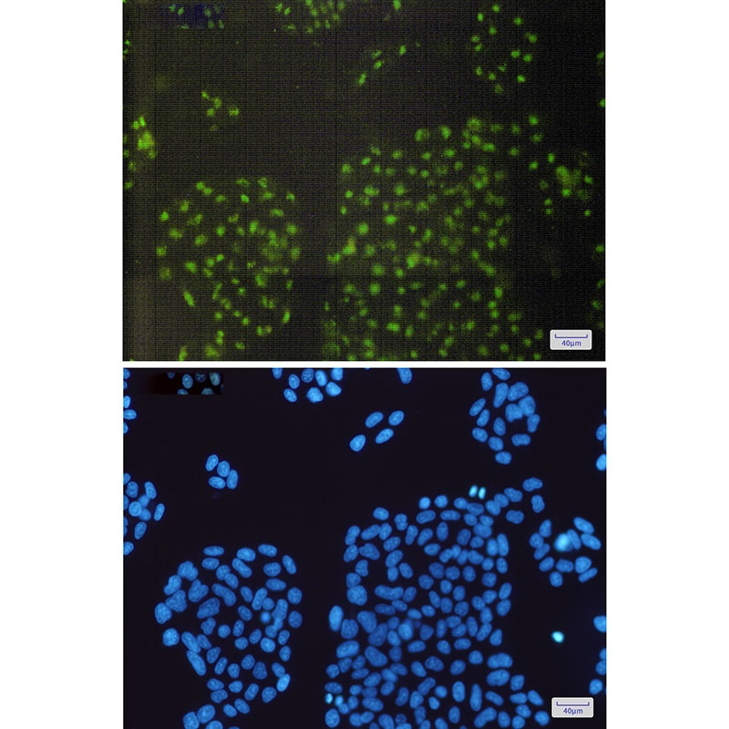 CRYAB Antibody
