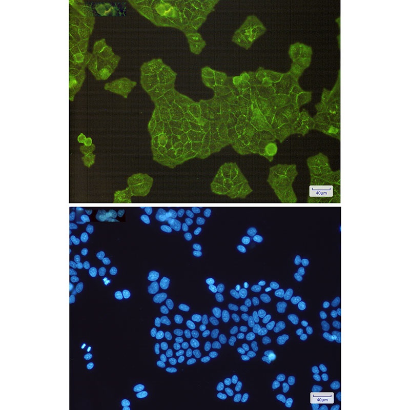 ACTN4 Antibody