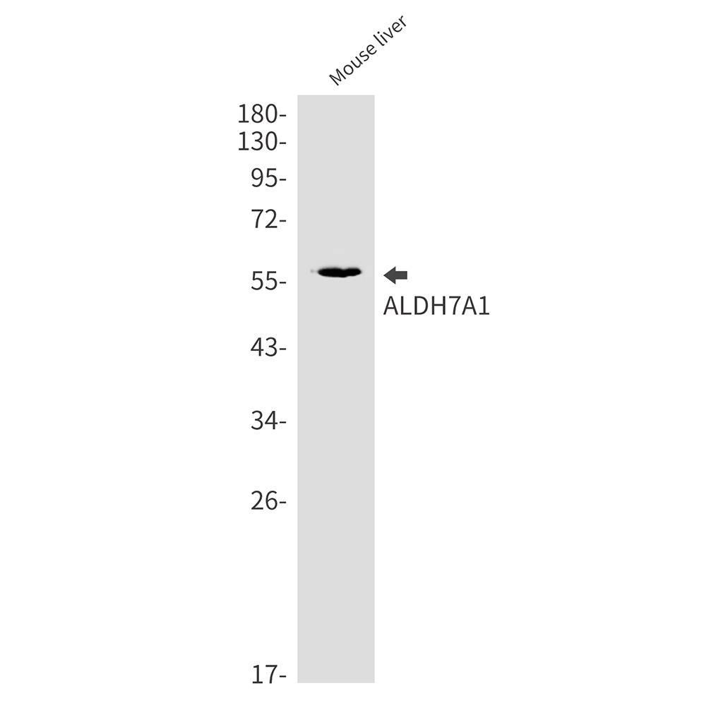 ALDH7A1 Rabbit mAb