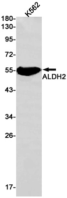 ALDH2 Rabbit Monoclonal Antibody