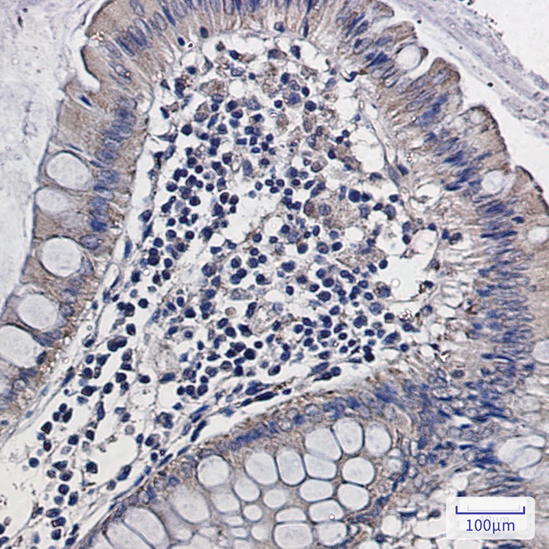 ALDH2 Rabbit Monoclonal Antibody