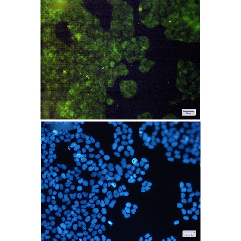 AdSS 2 Rabbit mAb