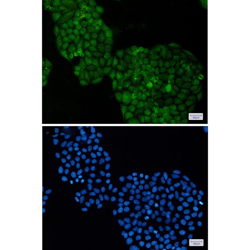 ADRM1 Antibody
