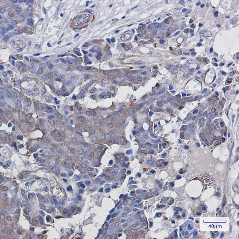 ADRM1 Antibody