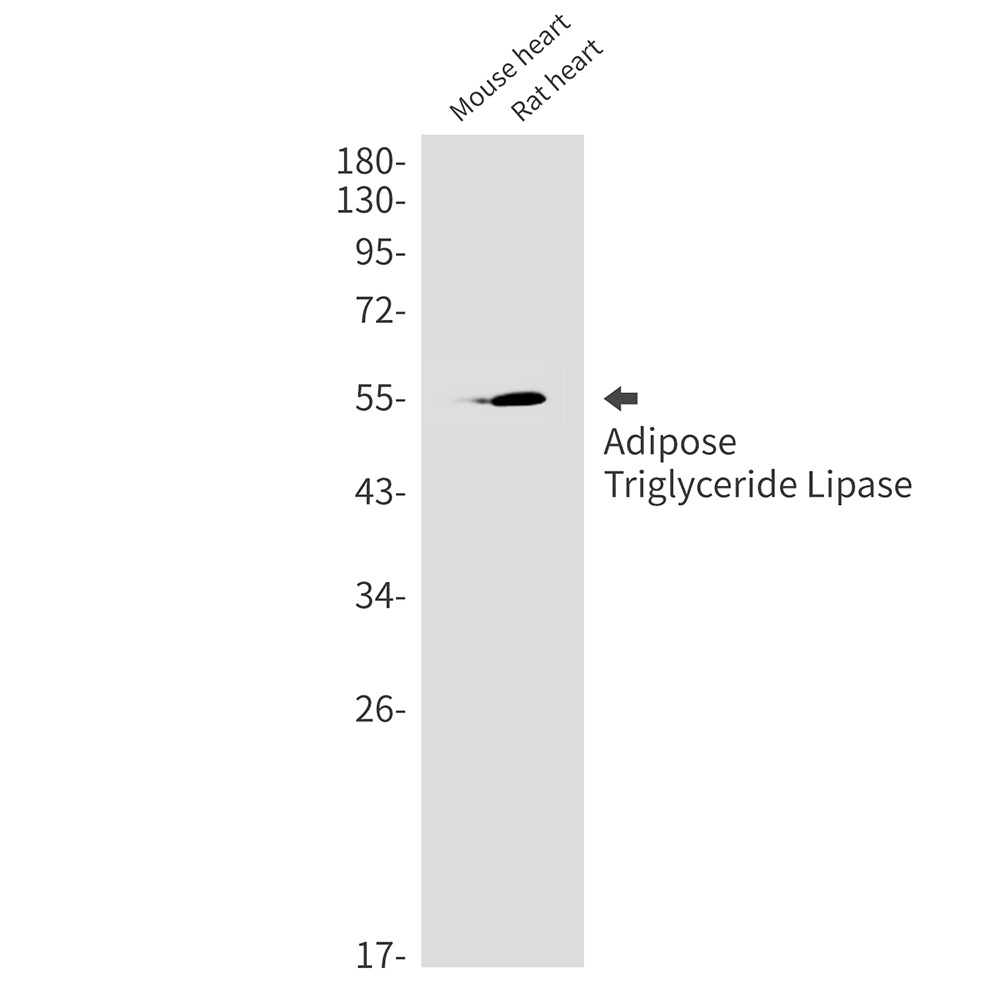 Adipose Triglyceride Lipase Rabbit Monoclonal Antibody