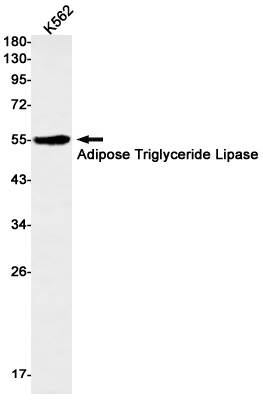 Adipose Triglyceride Lipase Rabbit Monoclonal Antibody