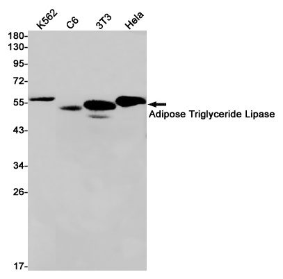 PNPLA2 Antibody