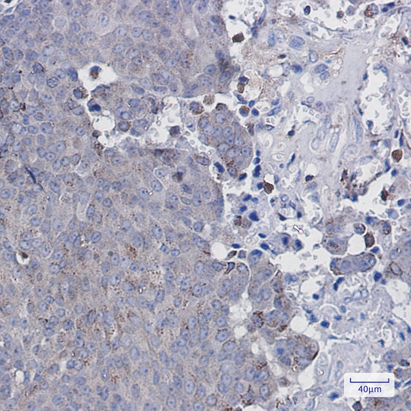 PNPLA2 Antibody
