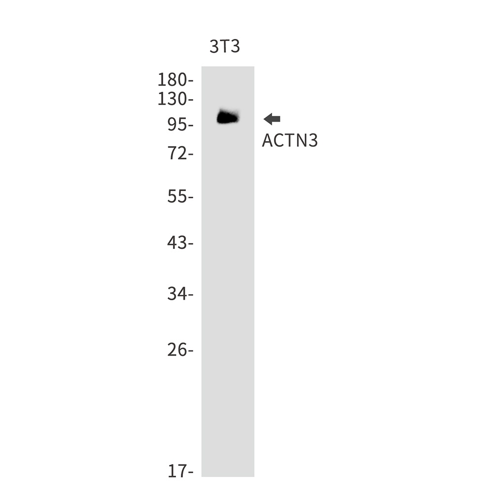 ACTN3 Rabbit mAb