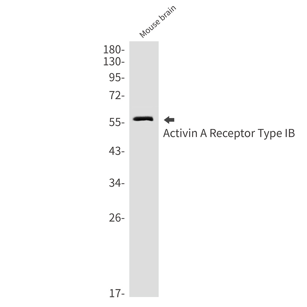 ACVR1B Antibody
