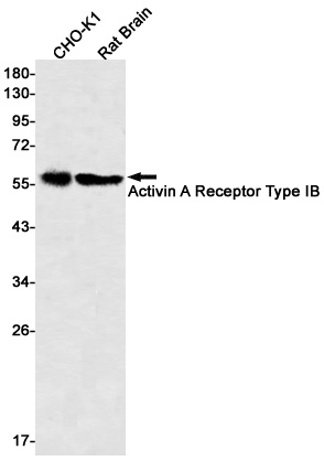 ACVR1B Antibody