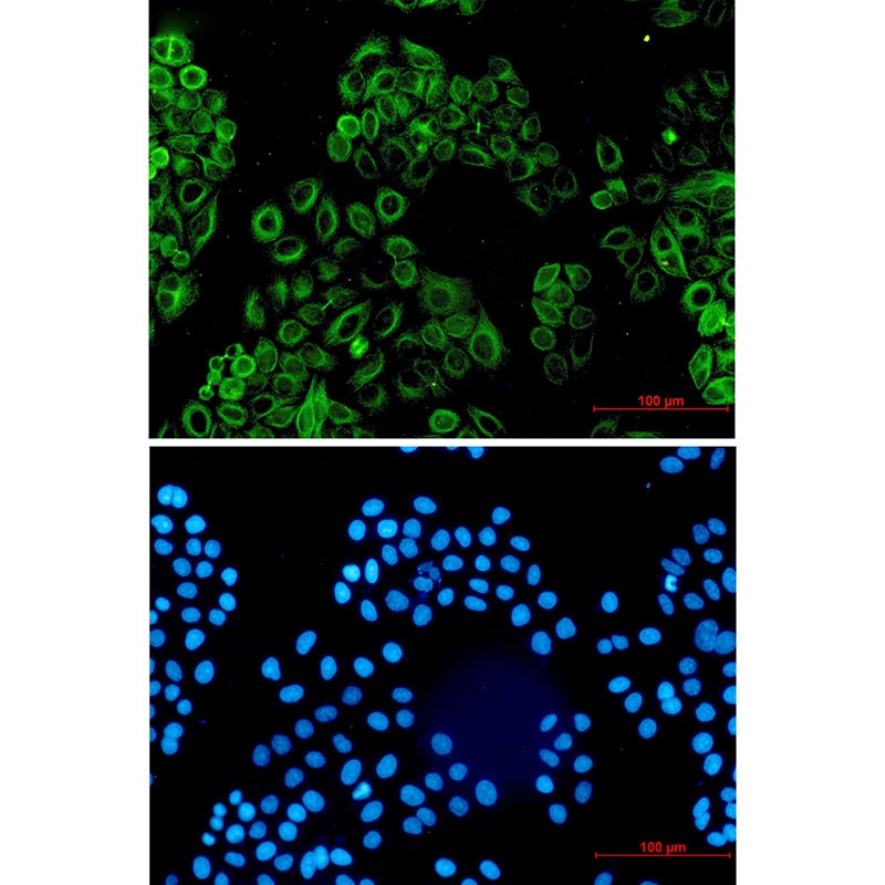 ACVR1B Antibody