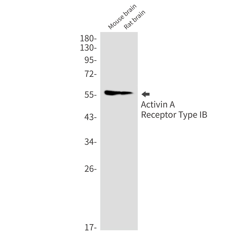 Activin A Receptor Type IB/ALK-4 Rabbit Monoclonal Antibody