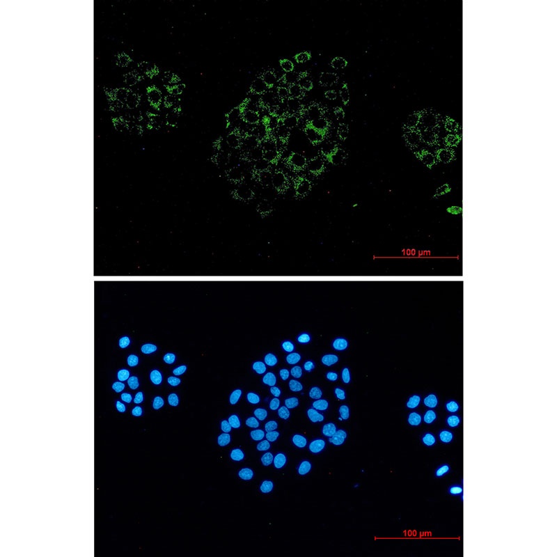 ACOX1 Rabbit mAb
