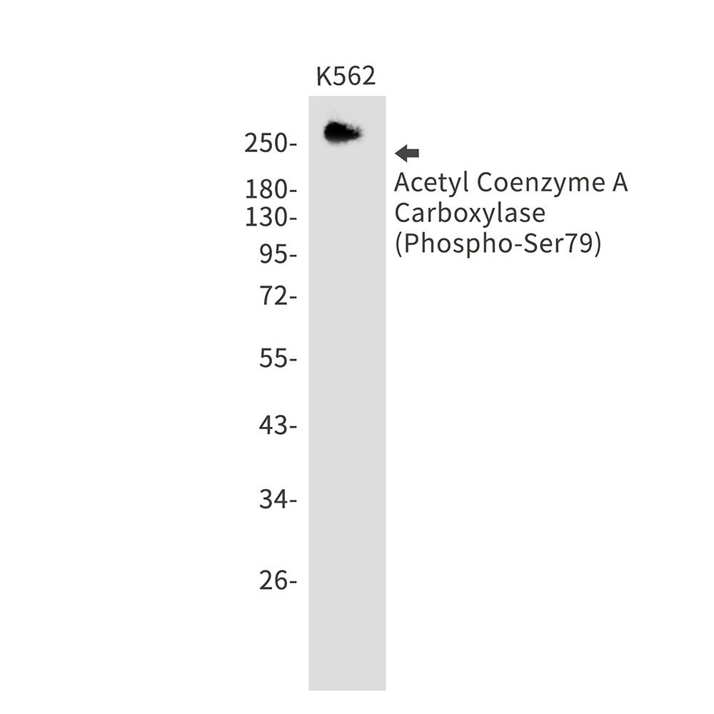 Phospho-Acetyl Coenzyme A Carboxylase (Ser79) Rabbit mAb