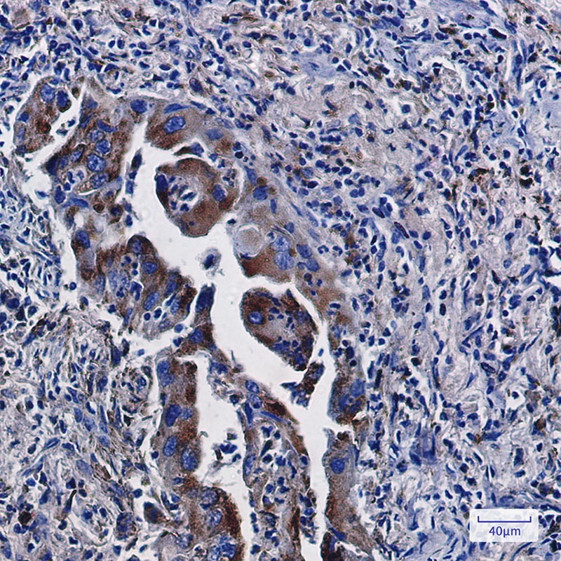 LAMP2 Rabbit Monoclonal Antibody