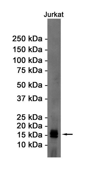 eIF5A Rabbit mAb