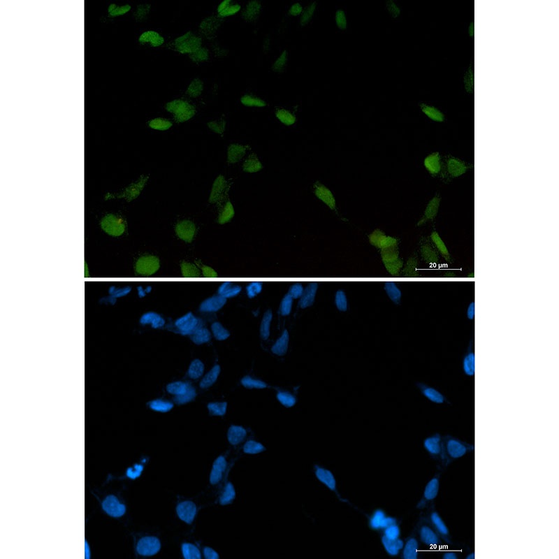 JUN Antibody